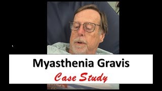 Myasthenia Gravis Case Study [upl. by Lekcar]