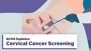 ACOG Explains Cervical Cancer Screening [upl. by Ennayllek]