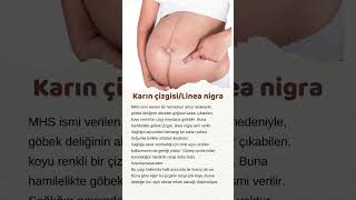 Karın çizgisiLinea nigra bebekbakımı baby evlilik [upl. by Htir639]