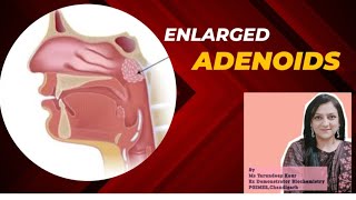 What are Adenoids Causes amp Symptoms of Enlarged AdenoidsAdenoiditis [upl. by Zerk]