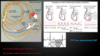 Hemodynamic Monitoring Part 1 [upl. by Ap]