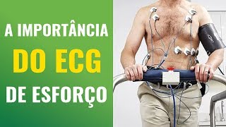 A IMPORTÂNCIA DO ECG DE ESFORÇO NOS EXERCÍCIOS [upl. by Jordon]