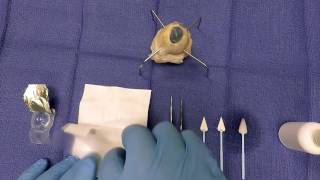 Application of Amniotic Membrane on the Eye [upl. by Pitt53]