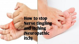 How to stop itchy feet and hands Nerve itching Neuropathic itch [upl. by Ozmo]