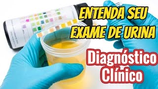 ✓DIAGNÓSTICO  Interpretando exames clínicos 2  Urinálise Exame de Urina como entender [upl. by Leksehcey]