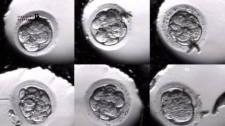 IVF PROCESS STEP BY STEP In Vitro Fertilisation Embryo cultivation [upl. by Ecnerwaled509]