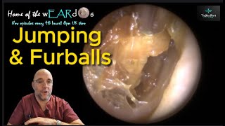 Jumping and Furballs 220 ear earwax earwaxremoval earcleaning asmr asmrearwax satisfying [upl. by Sharpe252]