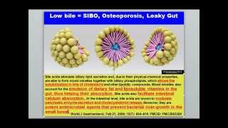 UPDATED MTHFR and SIBO  How SIBO Gut Infections Cause Methylation Problems [upl. by Odrick]