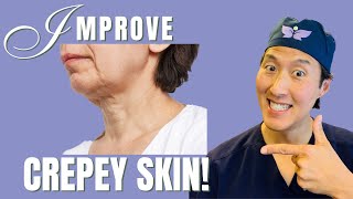 How To Improve Crepey Skin Holistically [upl. by Juta]