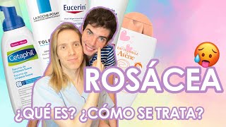 ¿Qué es la ROSACEA ¿Cómo se trata  Productos que recomiendo [upl. by Collis]