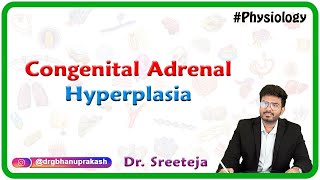 Congenital Adrenal Hyperplasia  USMLE Step 1 [upl. by Laehcimaj]