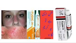 fucidin H cream usesSide EffectsDosage review in Hindi or Urdu [upl. by Llekim]