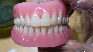 Upper Full Flexible Denture and Lower partial Denture [upl. by Blau]