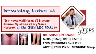 Erythema Multiforme VS SJS VS Erythema Nodosum all differentiating SBA amp MCQ ClueDrFahadFCPSP1MG [upl. by Iverson]