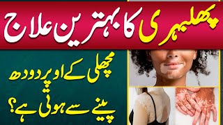 Vitiligo Skin Disease Treatment  Phulbari Ka ilaj  Vitiligo Starting Stage  Vitiligo Treatment [upl. by Anuala277]