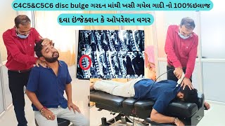 વડોદરા ના અર્પણભાઇ ને 2 વર્ષ નો ગરદન નો દુખાવો થયો સારો દવા કે ઑપરેશન વગરC4C5amp C5C6disc Bulge [upl. by Jonah150]