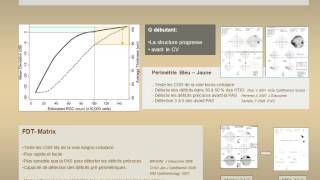 Surveillance du glaucome  Champ Visuel May F [upl. by Pyszka]