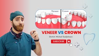 Veneer vs Crown  which is best for teeth  Doctor Gudjohnsen [upl. by Paschasia]