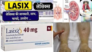 Lasix 40 mg tablet uses in hindi  Lasix Tablet  Furosemide 40 mg [upl. by Ailic]