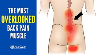 The Most OVERLOOKED Muscle That Causes Lower Back Pain [upl. by Oirretno]