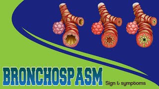 Bronchospasm  Risk factors  Management anaesthesia medicalstudent [upl. by Anama688]