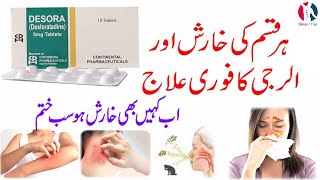 Desora 5mg tablet  Desora 5mg tablet uses in urdu  Desloratadine 5 mg tablets  Desora 5mg  hindi [upl. by Nart314]