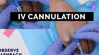 Intravenous IV cannulation  OSCE Guide  UKMLA  CPSA [upl. by Erinn103]