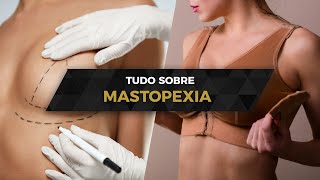 MASTOPEXIA  Tudo sobre a cirurgia plástica que remodela as mamas [upl. by Junie]