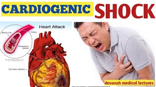 cardiogenic shock circulatory system and disease pathophysiology and cause [upl. by Zampino]