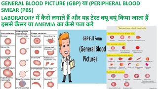 CBC SE GBP या PBS GENERAL BLOOD PICTURE or PERIPHERAL BLOOD SMEAR KI REPORT KAISE BANAYE [upl. by La]