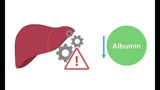 Getting to know albumin physiology [upl. by Rasia]