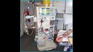 What are the Hemodialysis Working principle of Hemodialysis amp How to work Uses pros and cons [upl. by Nodyarg]