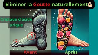 Comment vaincre la goutte sans médicaments 🌿💪Astuces naturelles pour un soulagement rapide [upl. by Lagasse]