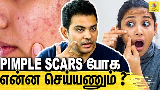 Pimpleஅ Remove Panalama   Dr Sethuraman Interview About Pimple Removing Tips amp Treatment [upl. by Nawak]