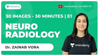 30 Images in 30 minutes  E1   Neuroradiology  NEET PG  Dr Zainab Vora [upl. by Newel822]