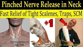 Wicked Neck Stretch for Fast Relief of Tight SCM Trap Scalene amp Pinched Nerve  Dr Mandell DC [upl. by Chauncey]