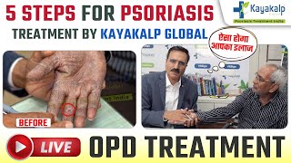 Step by Step Psoriasis Treatment by Kayakalp Global  Palmoplantar Psoriasis को कैसे ठीक करें [upl. by O'Shee]