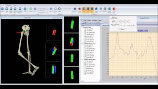 Gait analysis with bluetooth inertial sensors [upl. by Violeta620]