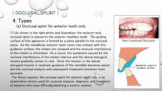 Occlusal splint [upl. by Attennaej]