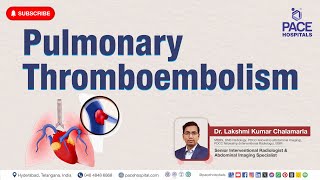 Pulmonary Thromboembolism PE  Cause Risk Factor Symptom Diagnosis Treatment amp Prevention [upl. by Lili]