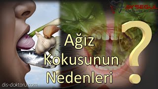 Ağız kokusu nedenleri  ne yapmalı  ağız kokusu nasıl giderilir [upl. by Reseta]