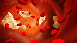 Analyse de sang  quel est le taux de cholestérol normal [upl. by Hoj]