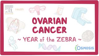 Ovarian cancer Year of the Zebra [upl. by Drice395]