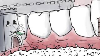 See How Fluoride Plus Xylitol Improves Dental Health  Xlear [upl. by Orgalim]