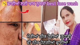 💁🏻 ਪੁਰਾਣੀਆਂ ਛਾਈਆਂ open pores ਕਰੇ ਦਸ ਦਿਨਾਂ ਚ ਠੀਕ [upl. by Anirok]