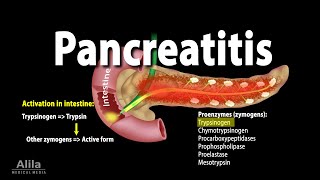 Pancreatitis Acute and Chronic Animation [upl. by Eiramanel]