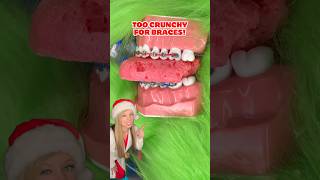 FOODS YOU CANT EAT WITH BRACES 👀 ORTHODONTIST REACTS CRUNCHY FREEZE DRIED CANDY FOOD ASMR shorts [upl. by Atteuqihc]