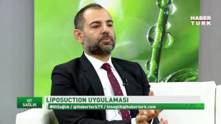 Liposuction uygulaması ve korse kullanımı devam ediyor mu [upl. by Philbert127]