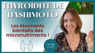 Hypothyroïdie d’Hashimoto régime alimentaire et solutions naturelles [upl. by Onej6]