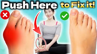 Instant Bunion Pain Relief Massage  How to Fix Bunions Naturally at Home [upl. by Ynohtnaeoj853]